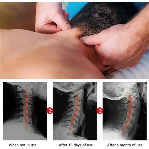 Trapezius Trigger Point Massager, Cervical Neck Traction Pillow Device - Picture 5 of 6